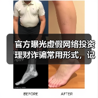 官方曝光虚假网络投资理财诈骗常用形式，记住三点谨防受骗（图1）